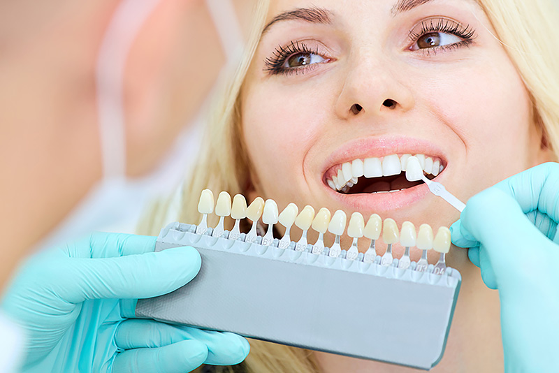 Hollywood-Smile Dr. Peter Servinis